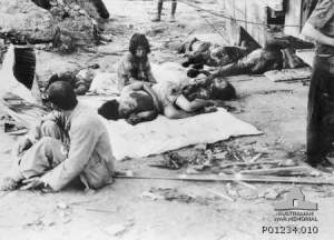 Hiroshima injuries